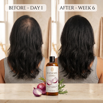Excalvo Red Onion + Rosemary Oil + Cinnamon Shampoo (Pack of 2)