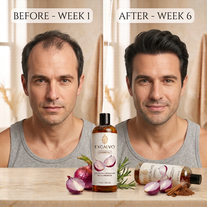Excalvo Red Onion + Rosemary Oil + Cinnamon Shampoo (Pack of 2)